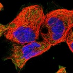 Anti-EPB41L5 Antibody