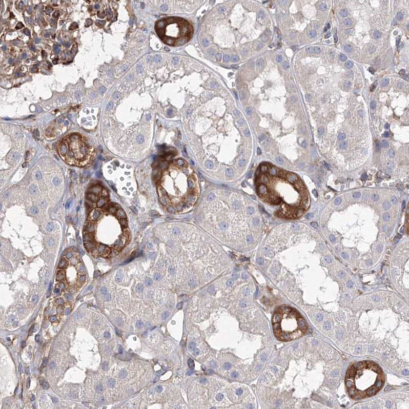 Anti-SNX18 Antibody