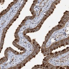 Anti-TRAF3IP1 Antibody