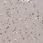 Anti-ZCCHC24 Antibody