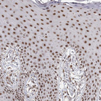 Anti-ZCCHC24 Antibody