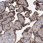 Anti-ZCCHC24 Antibody