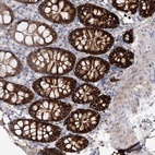 Anti-C11orf52 Antibody