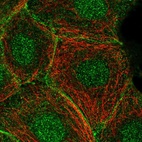 Anti-C11orf52 Antibody