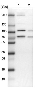 Anti-MCMBP Antibody