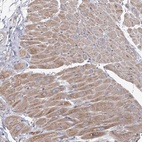 Anti-ANGPTL5 Antibody