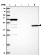 Anti-ANGPTL5 Antibody