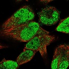 Anti-STAC3 Antibody