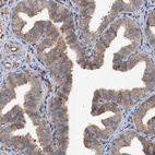 Anti-TAPBPL Antibody