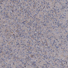 Anti-TAPBPL Antibody