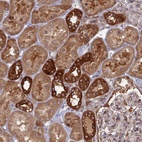 Anti-TBC1D30 Antibody