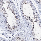 Anti-SPATA19 Antibody