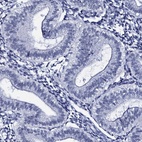 Anti-SPATA19 Antibody