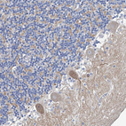 Anti-MRPL48 Antibody