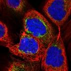 Anti-LRRC57 Antibody