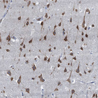 Anti-LSM14B Antibody