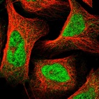 Immunofluorescent staining of human cell line U-2 OS shows localization to nucleoplasm.