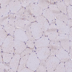 Anti-DNAJB9 Antibody