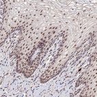 Anti-CD3EAP Antibody