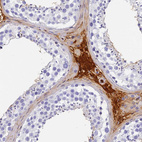 Anti-ITIH1 Antibody