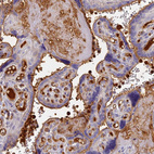 Anti-ITIH1 Antibody