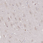 Anti-DIMT1 Antibody