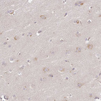 Anti-DIMT1 Antibody