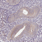 Anti-DIMT1 Antibody