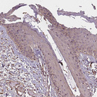 Anti-DIMT1 Antibody