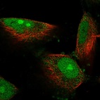 Anti-DIMT1 Antibody