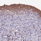 Anti-GIPC1 Antibody