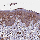 Anti-WWC2 Antibody