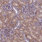 Anti-FBRS Antibody