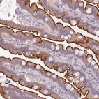 Anti-TMEM236 Antibody