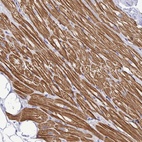 Immunohistochemical staining of human heart muscle shows high expression.