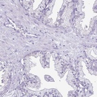 Immunohistochemical staining of human prostate shows low expression as expected.