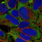 Immunofluorescent staining of human cell line HEK 293 shows localization to cytosol & vesicles.