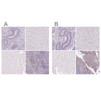 Anti-DSG3 Antibody