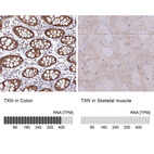 Anti-TXN Antibody