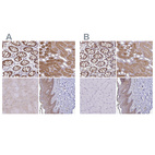 Anti-TXN Antibody