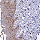 Anti-TXN Antibody