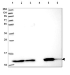 Anti-TXN Antibody