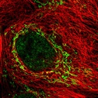 Anti-SDC3 Antibody