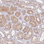 Immunohistochemical staining of human kidney shows weak cytoplasmic positivity in cells in tubules.