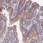 Immunohistochemical staining of human duodenum shows moderate cytoplasmic positivity in goblet cells.