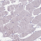 Immunohistochemical staining of human skeletal muscle shows no positivity in myocytes as expected.