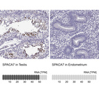 Anti-SPACA7 Antibody