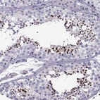 Anti-SPACA7 Antibody