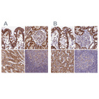 Anti-HSDL2 Antibody