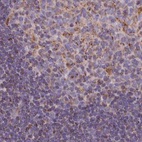 Anti-HSDL2 Antibody